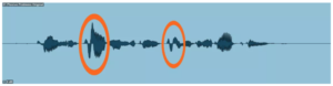 【歌ってみた・ボーカルMIX】よくある破裂音の問題とその対処法